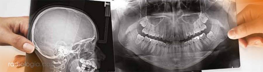 Radiología Digital / Dental